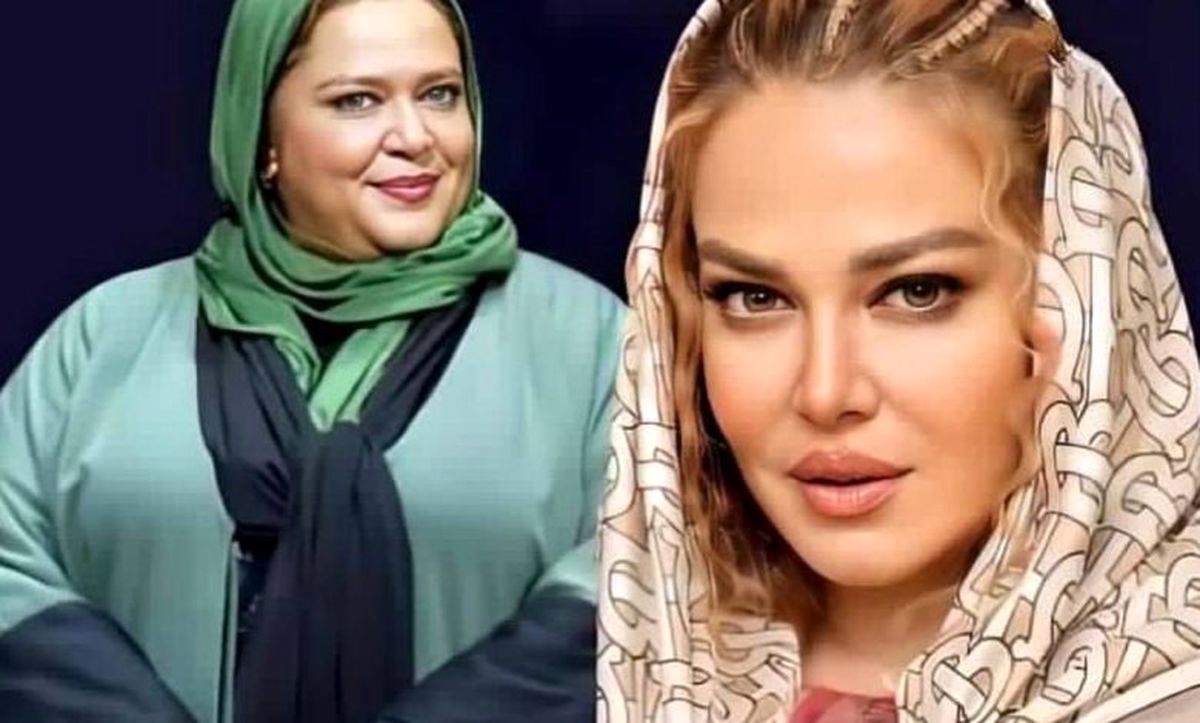 بهاره رهنما قبل و بعد